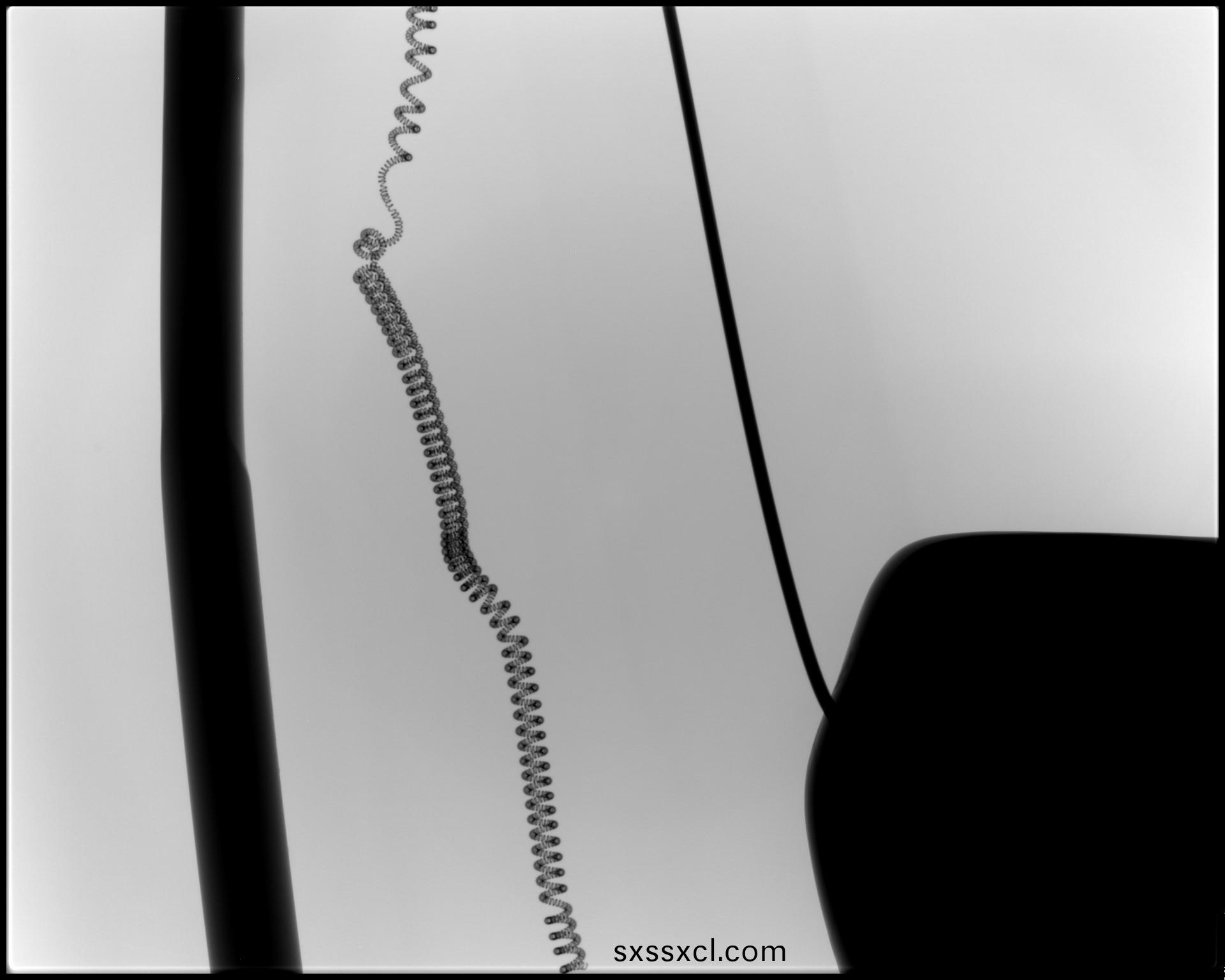 1596681135151170.jpg 1596681135151170.jpg