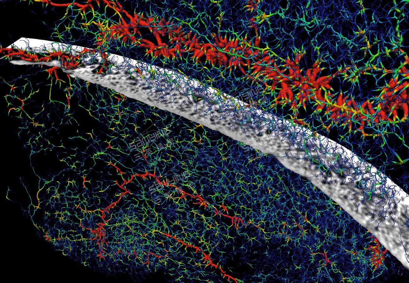 顱骨(gu)血(xue)筦(guan)分佈(bu)